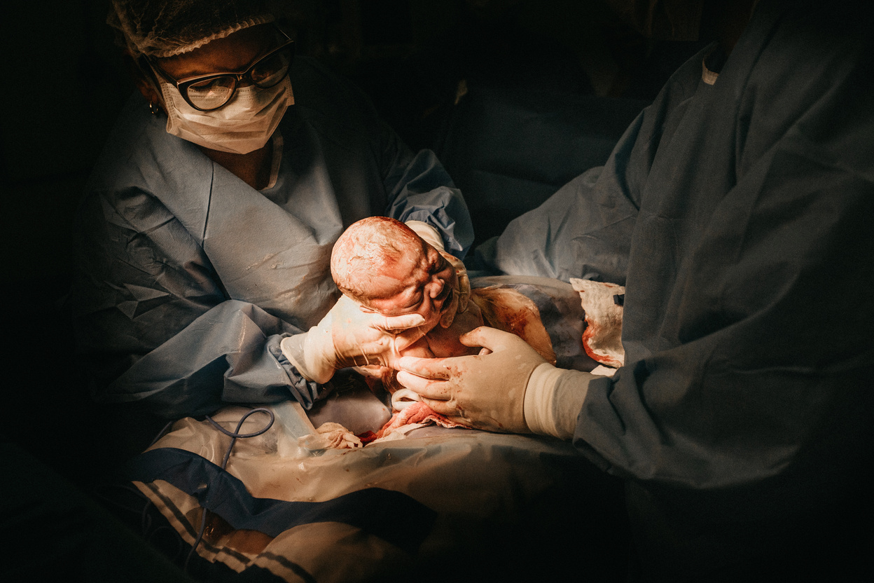 Woman Giving Birth to Baby Via C-section
